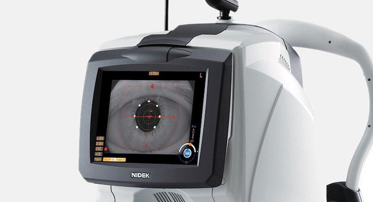 scanner-tco-eye-exam